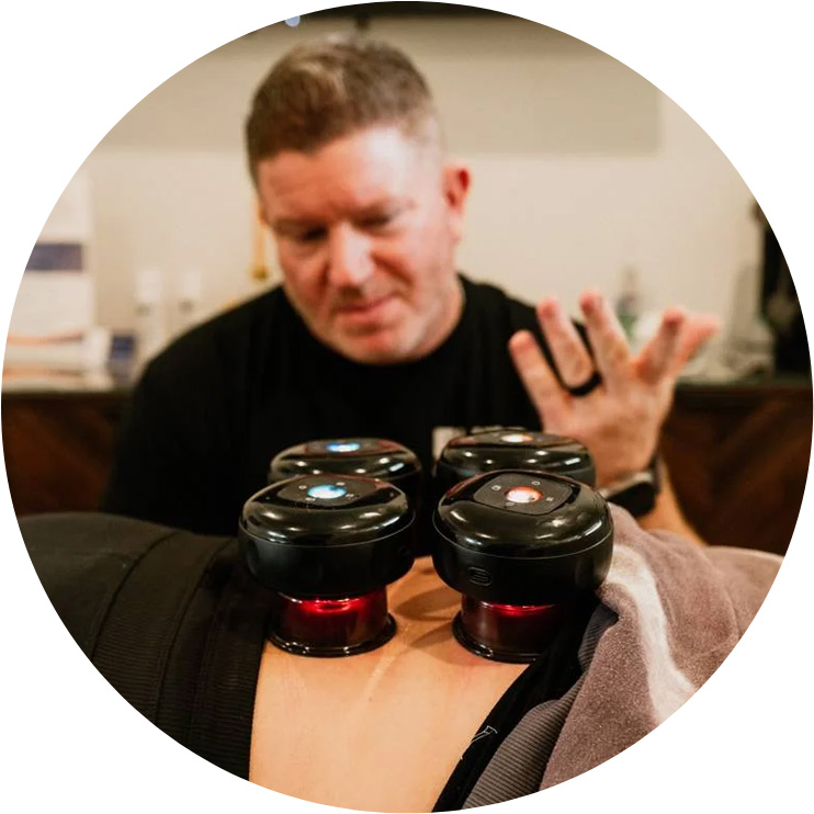 Cupping-Therapy-for-Muscle-Pain