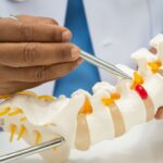 What Does Spinal Cord Compression Feel Like? Early Warning Signs You Shouldn’t Ignore