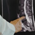 How Spinal Decompression Works — And Why It’s So Effective