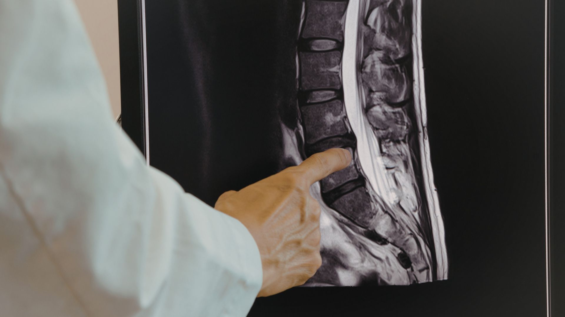 How Spinal Decompression Works — And Why It’s So Effective