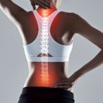 Spine Conditions
